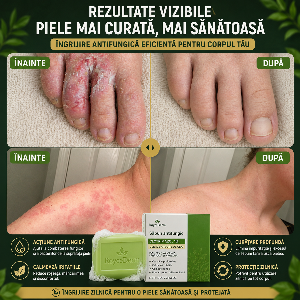 Săpun Antifungic cu Ulei de Arbore de Ceai 1+1 GRATIS